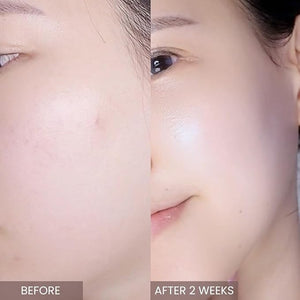 aplin Pink Tea Tree Intensive Cream - 50g/Skin Moisturizer/Facial Moisturizers/1.7 Oz CICA Allantoin Korean Skin Care Moisturizer Hydrating