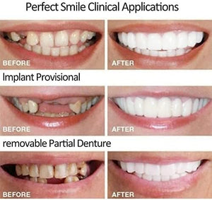 2 Pairs, Top and Bottom, Nature and Comfortable to Regain Confident Smile