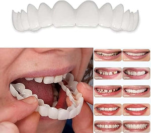 Temporary Adjustable Smile Support - 2 Pairs, Comfortable &amp; Secure, Top &amp; Bottom Included? (1)