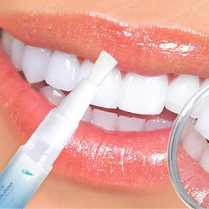 Clevermart Teeth Whitening Essence, Clevermart Teeth Whitening Pen, Effectively Removes Tooth Stains (5 Pcs)