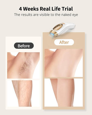 Laser Hair Removal for Women and Men - IPL Hair Removal with Ice-Cooling System for Painless &amp; Long-Lasting Result, Whole Body Hair Removal