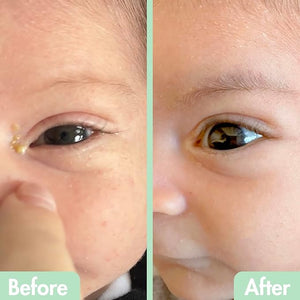 GlamBaby Eye Care - Eye Boogies¢â Eyelid Cleaning Spray | Non-Toxic Sting-Free &amp Wipe-Free Formula | Kids' Eyes Clean | Kids Eye Drops Sprayer | Baby Eye Drops Spray | Child Eyelid Cleanser (1 Pac