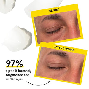 Lumin Men¡¯s Dark Circle Defense Balm ? Hydrating Eye Cream with Caffeine &amp Niacinamide Korean Skincare for Men Reduces the Look of Puffiness Fine Lines &amp Dark Circles Daily &amp Night Use