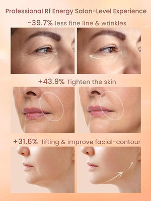 Radio Frequency Skin Tightening Device RF Face Machine for Anti-Aging Wrinkle Reduction &amp Jawline Lifting Professional Wireless Home Use with 3 Levels
