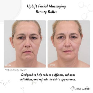 Nurse Jamie Uplift Facial Massaging Beauty Roller - Facial Massager with 24 Stones for Sculpting, Firming &amp; Reducing Puffiness