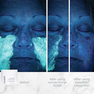 NassifMD Exfoliating Detox Pads | Surgeon-Created AHA/BHA Facial Pads for Deep Cleansing Smoother Texture &amp Glowing Skin | Reduces Pores Firms Brightens