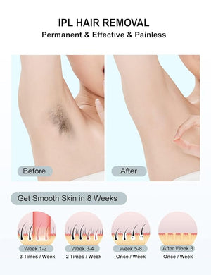 IPL Hair RemovalLaser Hair Removal At-Home for Women Men 999999 Flashes Permanent Removal Device on Facial Legs Arms Bikini Line