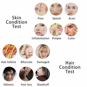 Milltrip 5 Inch Rechargeable Scalp Hair Detector Hair Follicle Analyzer &amp Skin Pigment Tester with 50X or 200X Lens Fit for Oil Dryness Inflammation(100-240V EUUSUK Plug)