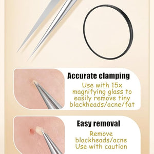 Acssart Blackhead Tools, 2025 New Stainless Steel Acssart Blackhead Tweezers, Stainless Steel Blackhead Remover Tool Kit with 15x Magnifying Glass (10Pcs)