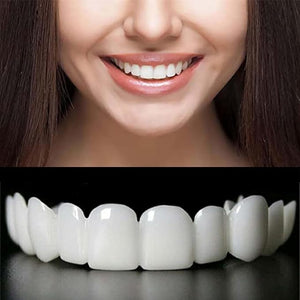 Temporary Adjustable Smile Support - 2 Pairs, Comfortable &amp; Secure, Top &amp; Bottom Included? (1)