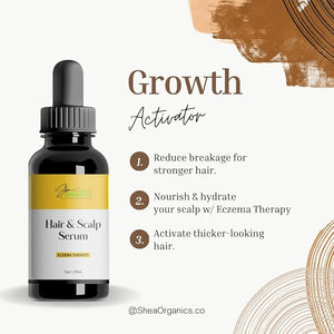 Shea Organics Soothing Scalp Oil ? 1 OZ | Relief for Dry Itchy Scalp Dandruff &amp Cradle Cap | Gentle Moisturizer for Baby Eczema &amp Sensitive Skin | Oat Oil Vitamin E Honey &amp Tea Tree