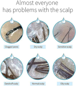 Scalp Hair Detector with 50X and 200X Lens 2 Million Pixel HD LCD Screen Comprehensive Skin Detection Freeze Frame Image Suitable for Home Beauty Salon spa