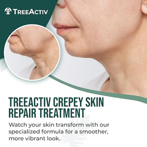 TreeActiv Crepey Skin Repair Cream, 8 oz, Firming Formula with Hyaluronic Acid &amp; Shea Butter to Deeply Moisturize and Tighten Dry, Wrinkly Crepe Skin, 500+ Uses
