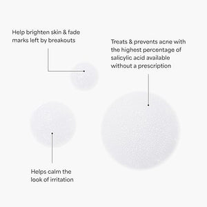 TULA Skin Care Keep It Clear - Acne Foam Cleanser Contains Salicylic &amp Azelaic Acid &amp Probiotics Clears &amp Soothes Acne Brightens Past Blemish Marks 6.3 fl oz.