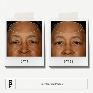 Rodan + Fields Redefine Daily Face Clay Cleanser (125 mL) | Advanced Skin Care | Exfoliating Face Wash &amp; Face Mask for Sensitive Skin | Anti-Aging Face Cleanser for Women and Men