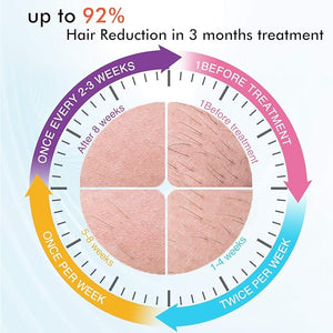 IMENE Permanent Hair Removal Machine for Women &amp Men 500000 Flashes IPL System with Ice Care Function for Full Body Home Use - Safest and Fastest IPL Technology