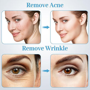 Microderm Machine with Spray Gun mcwdoit Professional Facial Skin Care Beauty Device Home Salon (Suction Power: 0-68cmhg)