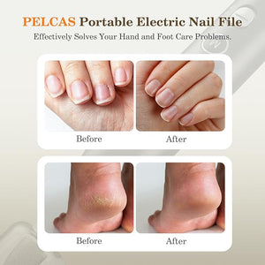 PELCAS Electric Nail Grinder 10 Speeds Cordless Nail Drill with LED Light Portable Manicure and Pedicure Kit Nail File with LCD Screen for Human Pet Thick Toenails Natural &amp Acrylic Nails Gr