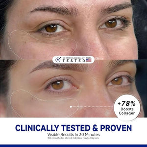 Peptide Under Eye Patches Firming Eye Patches Instant Reduces Dark Circles and Puffiness Collagen Under Eye Mask for Bags Treatment Wrinkles 60 Pairs