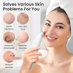 UNOISETION Diamond Microdermabrasion Machine, Portable Blackhead Remover Pore Vacuum, Dermabrasion Facial Machine for Exfoliation &amp; Blackhead Removal