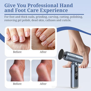 PELCAS Electric Foot Callus Remover with LED Screen Upgraded Electric Foot File 2 in 1 Manicure &amp Pedicure Kit for Women &amp Men Cordless Feet Filer for Foot Callus Thick Nails Finger Nails