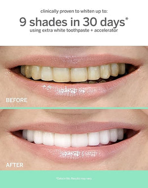 Supersmile Extra White Professional Whitening Accelerator - Enamel-Safe Teeth Whitening Gel - Effectively Lifts Deep-Set Stains Without Sensitivity - 7 oz