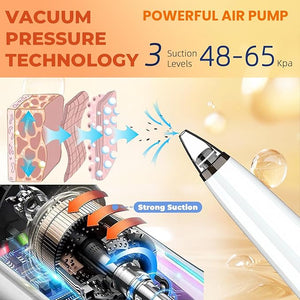 2025 Pore Vacuum, USB Rechargeable Blackhead Remover Vacuum,3 Levels Adjustable Pore Vacuum Blackhead Remover, with 6 Suction Power Probe,4 Golden Needle face Vacuum Pore Cleanser Kit-White