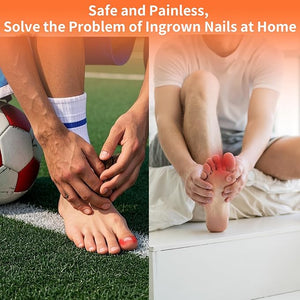 5 Sizes 10 Pcs - Ingrown Toenail Treatment Kit Titanium Alloy Ingrown Toenail Removal Kit Nails Corrector Tool &amp Remover Strips - Ingrown Toe Nail Quick Relief(0.51/0.59/0.67/0.7/0.74 inches)