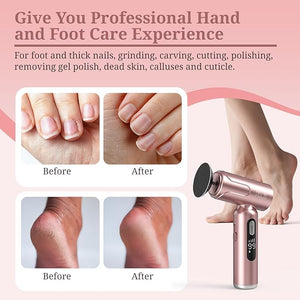 PELCAS Electric Foot Callus Remover with LED Screen 2 in 1 Manicure &amp Pedicure Kit 100 PCS Sandpapers Electric Foot File for Women &amp Men Cordless Feet Filer for Foot Callus Thick Nails Pin