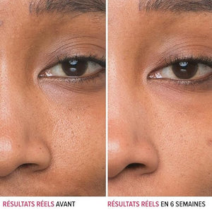 IT Cosmetics Bye Bye Pores 10% Glycolic Acid Face Serum - Visibly Minimizes Pores In 1 Week &amp Gently Exfoliates to Help Refine Skin¡¯s Texture - With Hyaluronic Acid for Hydration -1 Fl. Oz