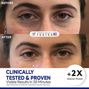 Peptide Cooling Under Eye Patches Soothing Eye Patches Instant Reduces Dark Circles and Puffiness Calming Under Eye Mask with Glacial Water for Bags Treatment 12 Pairs