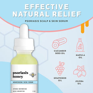 Psoriasis Honey Nourishing Scalp &amp Skin Serum - Dry Oil for Skin - Full Body Non Comedogenic Moisturizer Daily Dry Scalp Oil - Helps Psoriasis Eczema &amp More (1Oz)