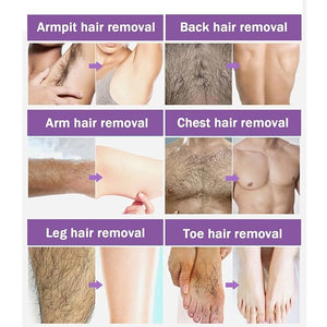 Hair Removal Spray for Women and Men,Painless Hair Removal Cream,For Unwanted Hair, All Skin Types,Bikini,Private Areas, Pubic, Body, Legs, and Underarms,soothing &amp; Effective,Smooth Results,5oz (3