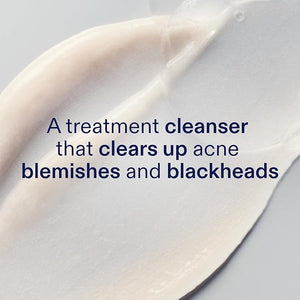 Skinfix 2% BHA Cleanser - 5 oz - Clears Acne Blemishes &amp Blackheads - Safe for All Types of Acne - Fragrance Free - Vegan Cruelty Free