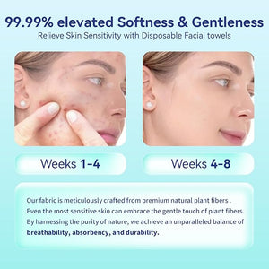 Ditoi Disposable Face Towels,Ultra Thick Face Towelettes XL, Lint-Free Facial Wipes for Makeup Removal &amp; Gentle Skin Care,10"¡¿12",150 Count (3 Pack),Pearl-textured