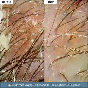 Briogeo Scalp Revival Scalp Care Essentials Set Soothe a Dry Flaky Itchy or Oily Scalp Vegan Phalate &amp Paraben-Free Value Kit