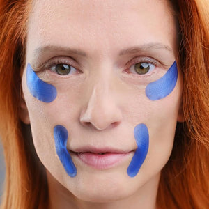 Qure Micro-Infusion Anti Wrinkle Patches for Smile Line Frown lines Under Eye Bags Puffiness Crow's Feet - Retinol Caffeine Niacinamide &amp Peptides - Dissolvable for Overnight Use - 24 Pairs