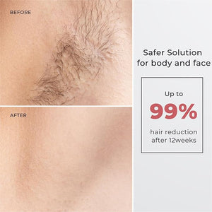Laser Hair Removal for Women and Men IPL with Ice-Cooling System for Nearly Painless And Long-Lasting Result At-Home Permanent Hair Removal Device 999999 Flashes for Whole Body Use