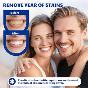 Teeth Whitening Pen - Effective Stain Removal Teeth Whitening Gel Kit Pro No Sensitivity Teeth Whitener for Bright White Travel-Friendly Mint