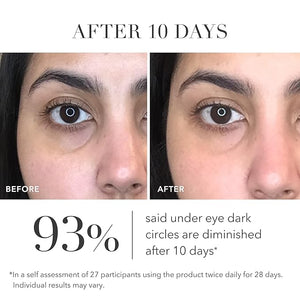 Algenist Triple Algae Eye Renewal Balm - Hydrating Vegan Eye Cream with Caffeine Alguronic Acid &amp Vitamin E to Help Reduce Dark Circles Puffiness Fine Lines &amp Wrinkles - Travel Size (0.5 oz