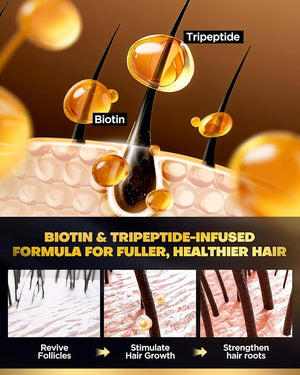 Tripeptide-Infused Hair Growth Biotin Shampoo and Conditioner Set Onion Anti-Loss Volumizing Moisturizing Treatment for Soft Shine Hair Dandruff Routine Rosemary Shampoo for Men and Women 2x16.9oz