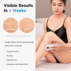 IPL Laser Hair Removal Device for Women &amp; Men - Home 45¡ÆF Ice-Cooling Contact for Painless &amp; Long-Lasting Results, 86% Hair Reduction in 3 Weeks for Full Body &amp; Bikini Line, White