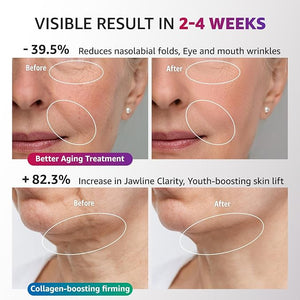 Red Light Therapy for Face and Neck, Renewal Face Lift Device with Vibration Tech, 3 in 1 Face Massager Tool with Thermals, True Beauty Glow Facial Sculptor for Wrinkles, Double Chin (White)