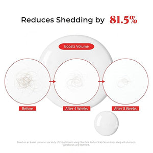 Revhan Scalp Serum for Hair Loss &amp; Thinning ? Hair Growth Serum for Men &amp; Women w/Salicylic Acid &amp; Centella Asiatica ? Soothes Itchy, Irritated Scalp with Roll-On