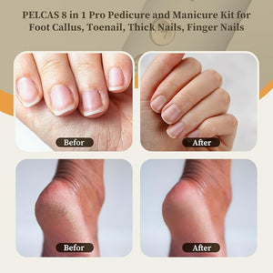 PELCAS 8 in 1 Cordless Nail Drill Electric Nail Filer 5 Speeds Manicure &amp Pedicure Kit with LED Light Electric Foot Callus Remover for Foot Callus Toenail Thick Nails Finger Nails Golden