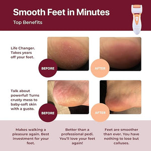 Rechargeable Callus Remover for Feet: Professional Electric Feet Sander for Women by Own Harmony - Electronic Foot File CR900 with 3 Rollers Foot Grinder Pedi Care for Cracked Heels &amp Dry Hard S