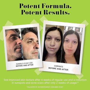 No Bad Stuff - Caffeine Eye Cream with Pure Hyaluronic Acid &amp; Plant Based Squalane Oil, Under Eye Cream for Dark Circles &amp; Puffiness, Gluten Free, Vegan, Travel Size, 0.5 FL Oz