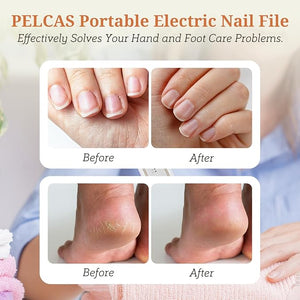 PELCAS Electric Toenail Grinder for Thick Toenails 5 Speeds Manicure and Pedicure Kit Cordless Nail Drill with LED Light Electric Nail File for Human Pet Thick Toenails Natural &amp Acrylic Nai