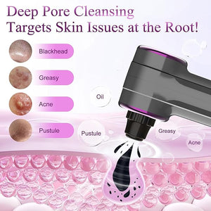 Blackhead Vacuum Removers, Pore Suction Cleaner with Heating, 3 Adjustable Suction Levels &amp; 9 Modes, Comedone Extractor Kit with 5 Heads for Nose &amp; Electric Face Deep Pore Cleansing