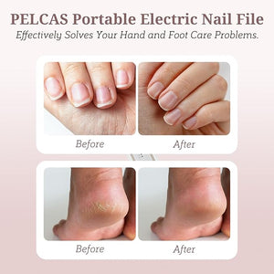 PELCAS Electric Nail File 5 Speeds Nail Grinder for Thick Toenails Cordless Nail Drill Manicure and Pedicure Kit with LED Light Toenail Grinder for Human Thick Toenails Natural &amp Acrylic Nai
